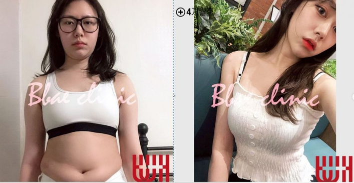 Slider image (5) BBAE Clinic